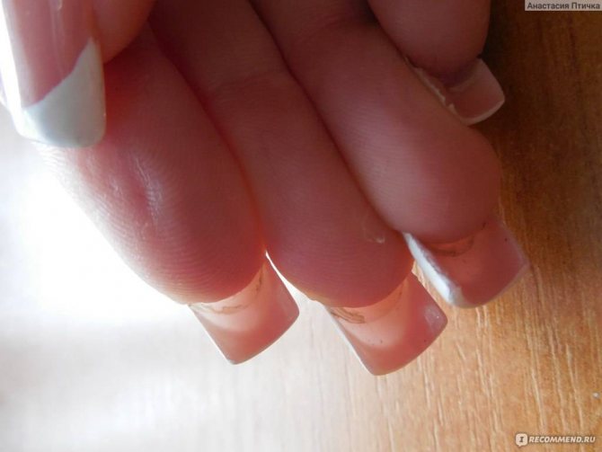 Опасно ли наращивание ногтей во время беременности?