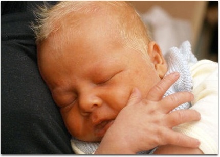 Повышенный уровень билирубина у новорожденных: причины, последствия, лечение