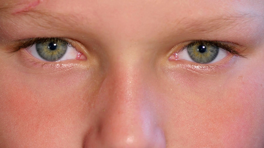 Как закапать капли в глаза ребенку правильно