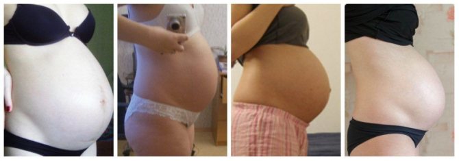 УЗИ на 32 неделе беременности