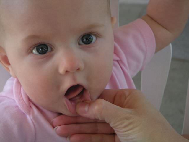 Первые зубы у младенцев